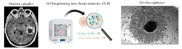 diagram of how brain sample is 3D printed to understand brain disease