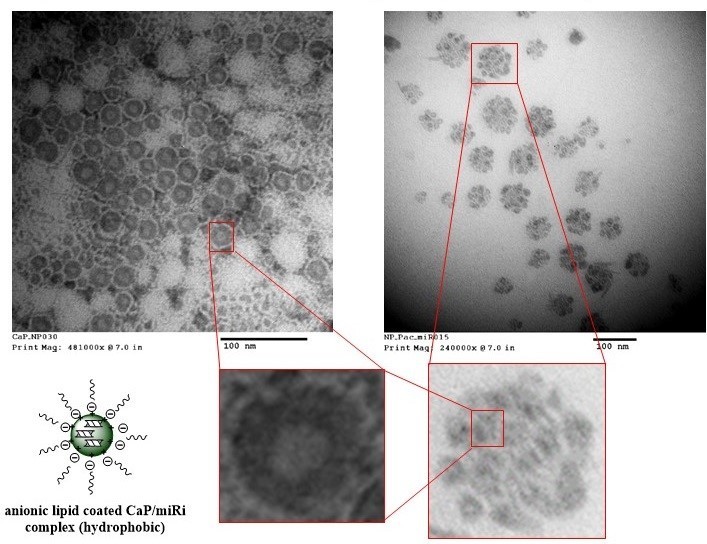 Hybrid nanoparticle for co-delivery of gene and drug