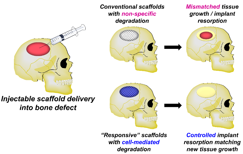 Diagram of injectable scaffold delivery into skull