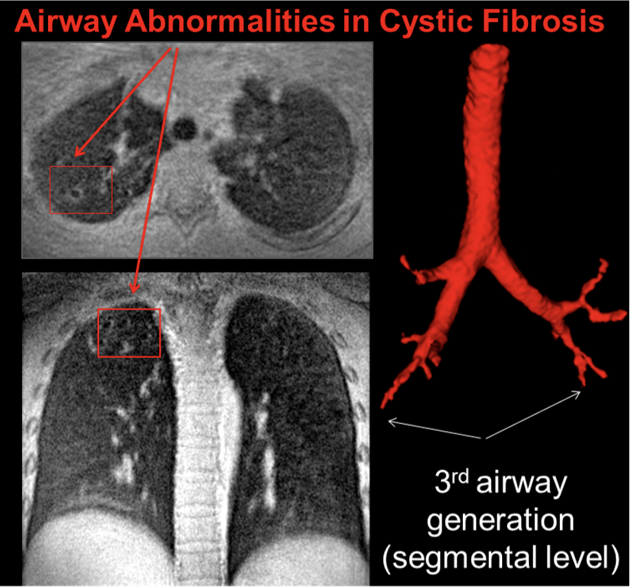 Standard Clinical Thoracic MRI Scan​