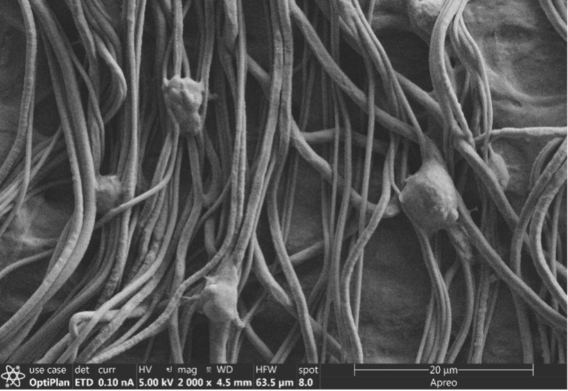 Closeup of tissue regeneration